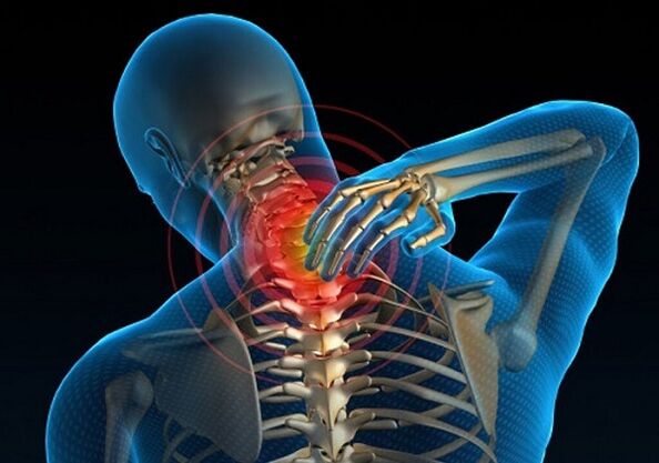 Dureri de gât din cauza osteocondrozei